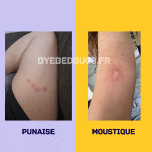piqure punaise ou piqure moustique